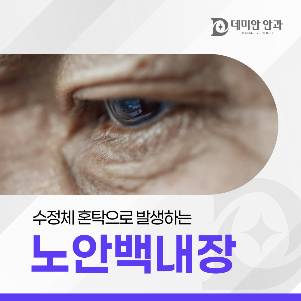 이미지 없음
